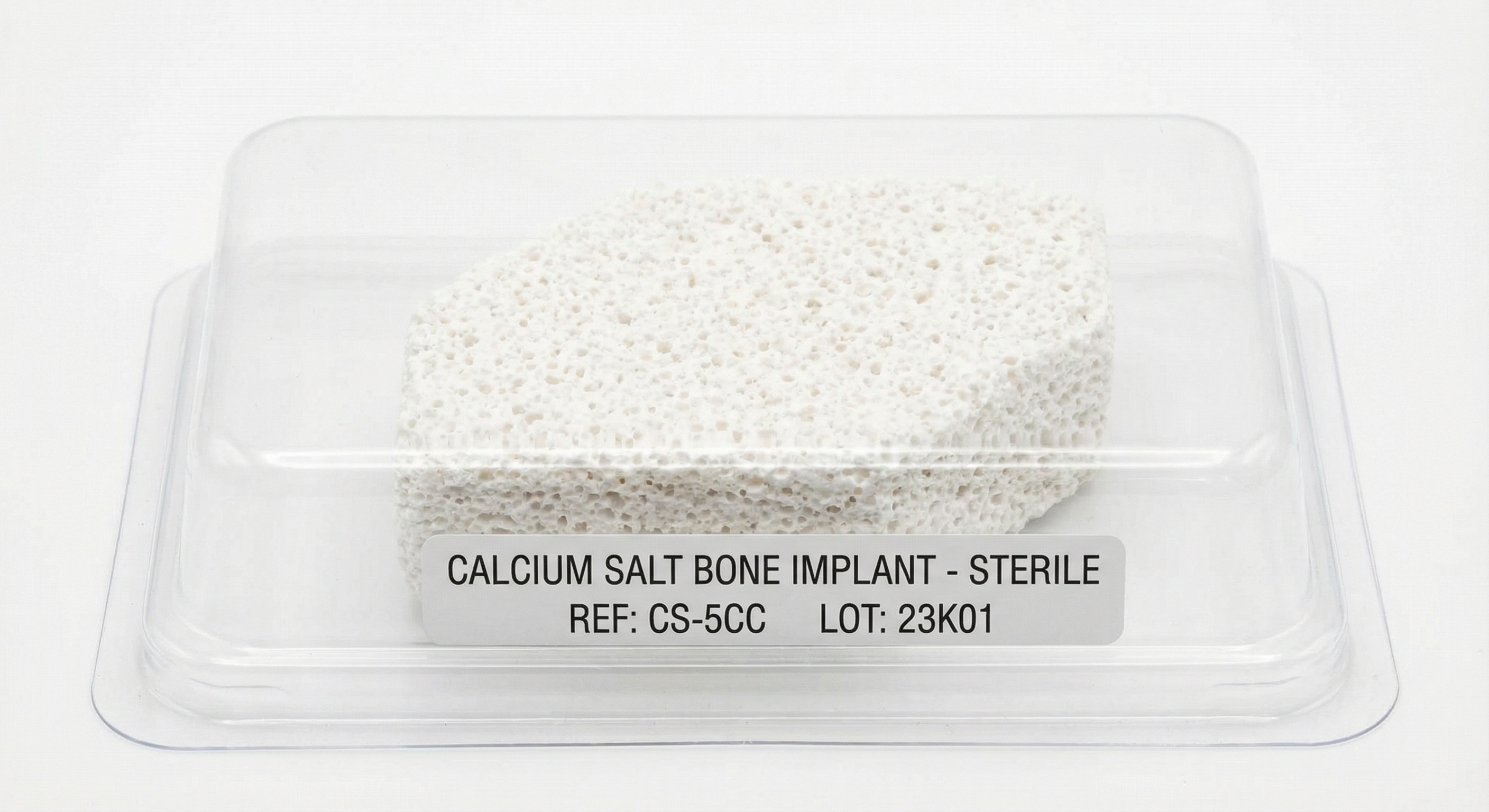 Calcium Salt Bone Implant