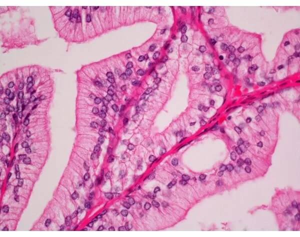 Hematoxylin-eosin Staining Technology (HE staining)