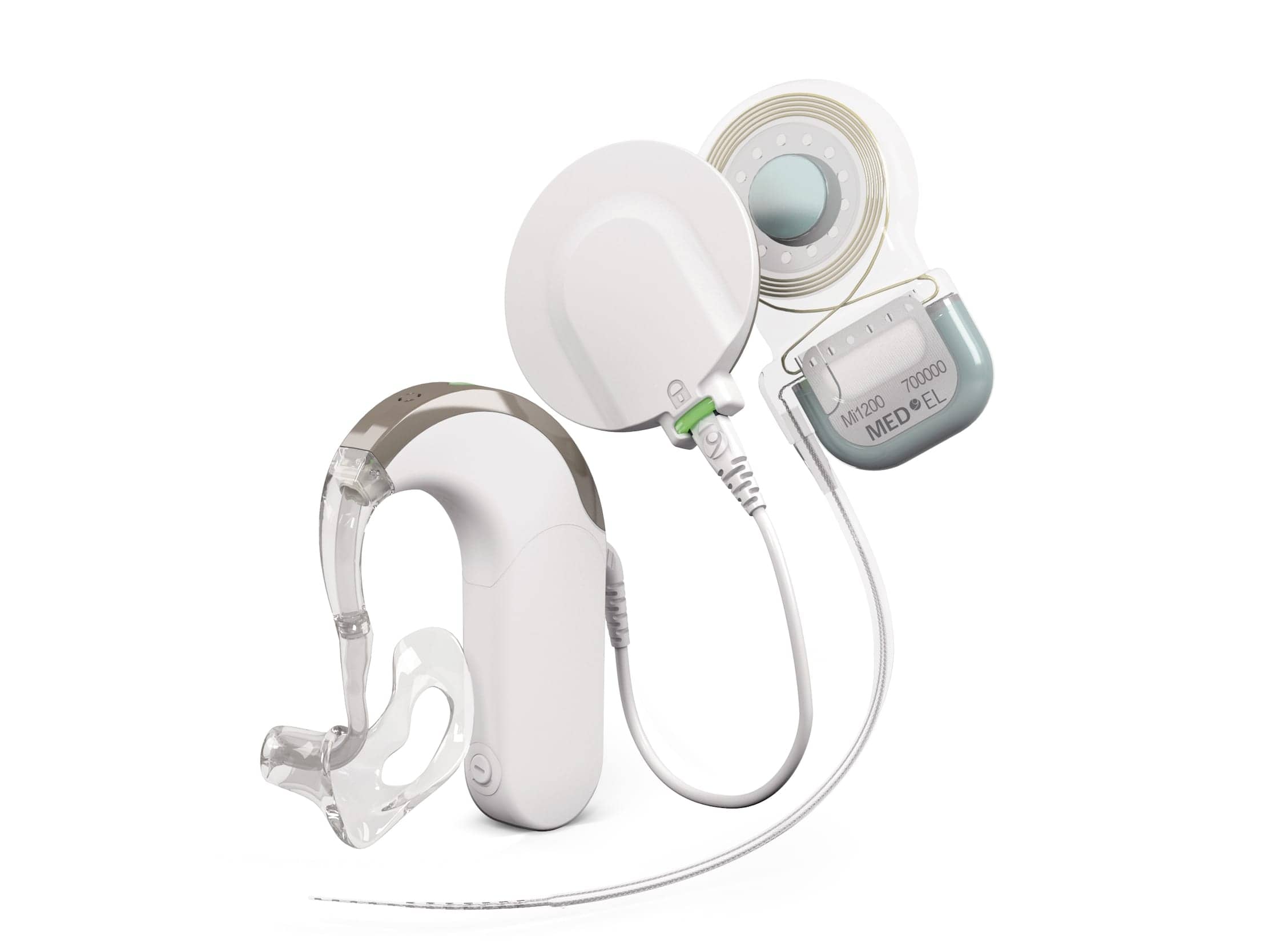 Implantable Bit Auditory Device