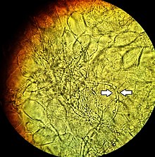 Optical Microscopy / Light Microscopy Technology