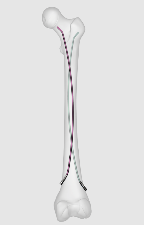 Orthopedic Active Device