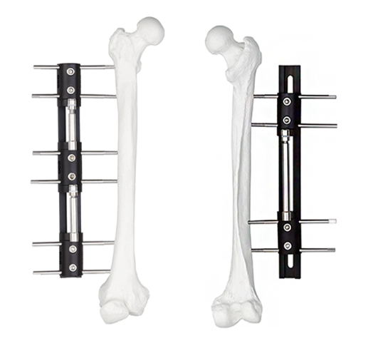 Orthopedic Fixation Instrument