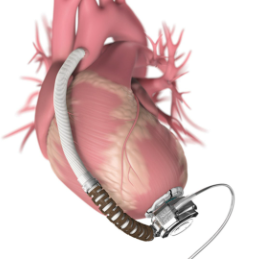 Other Active Implant