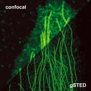 Stimulated Emission Depletion Microscopy