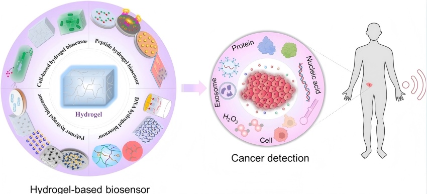Typical hydrogel-based biosensors.