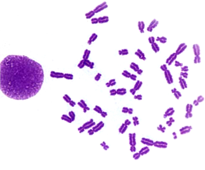 Human lymphocyte in metaphase showing a chromosome break with fragment.