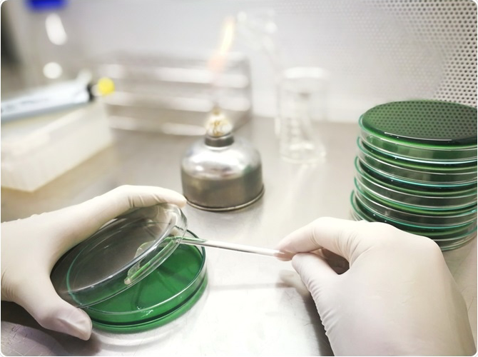 Microbial Identifications & Strain Typing