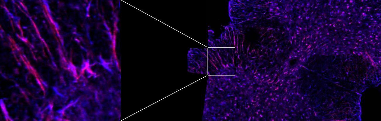 NCF1000 high-resolution confocal image (STEMart Authorized)