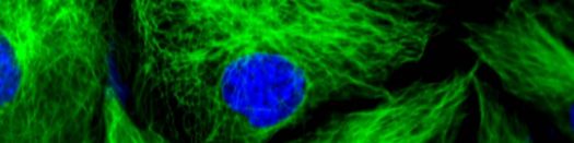 Super resolution microscopy abstract background (STEMart Authorized)