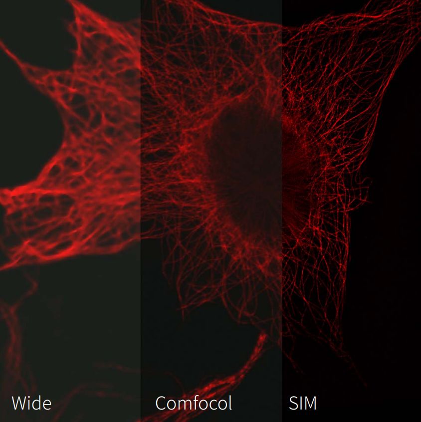 NSR1000 imaging mode comparison (STEMart Authorized)