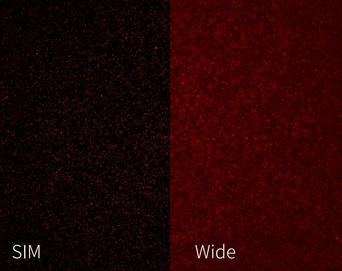 NSR1000 SIM vs widefield resolution (STEMart Authorized)
