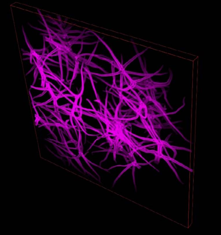 NSR1000 3D-SIM axial resolution (STEMart Authorized)